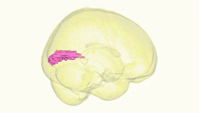 Full Brain White