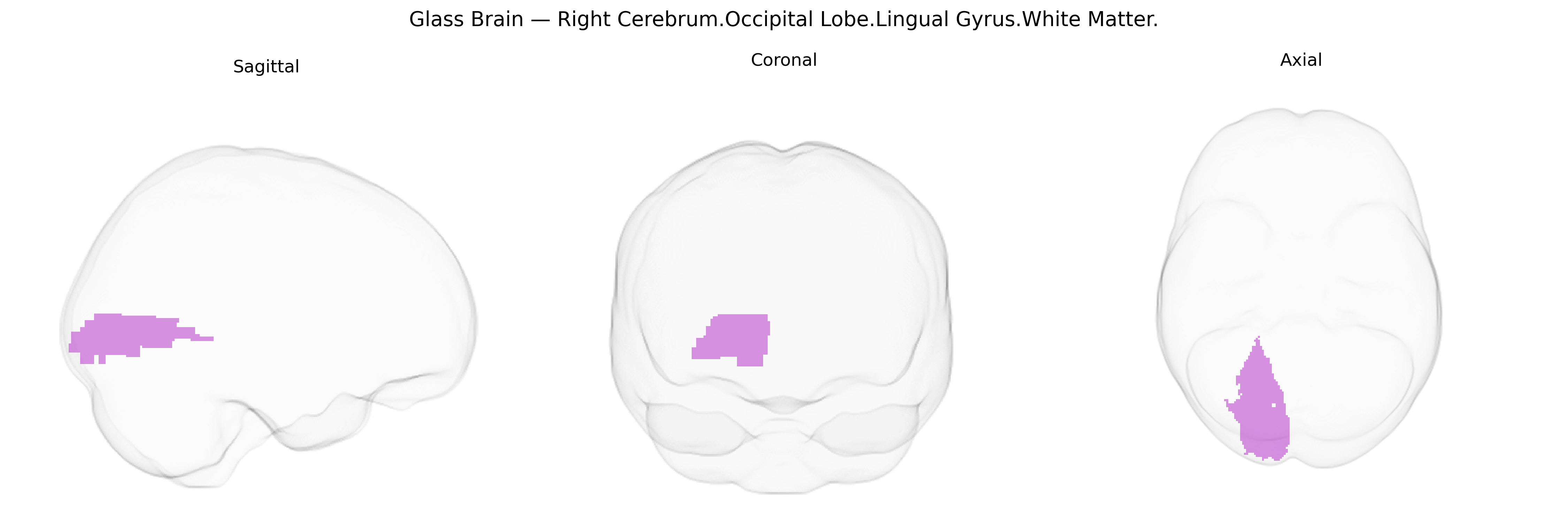 Triplanar Ghost Brain