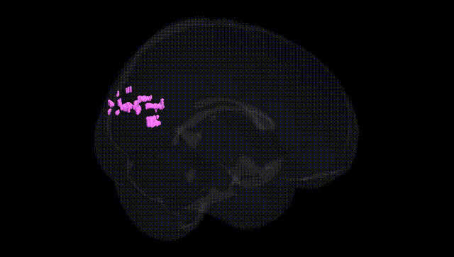 Full Brain Black