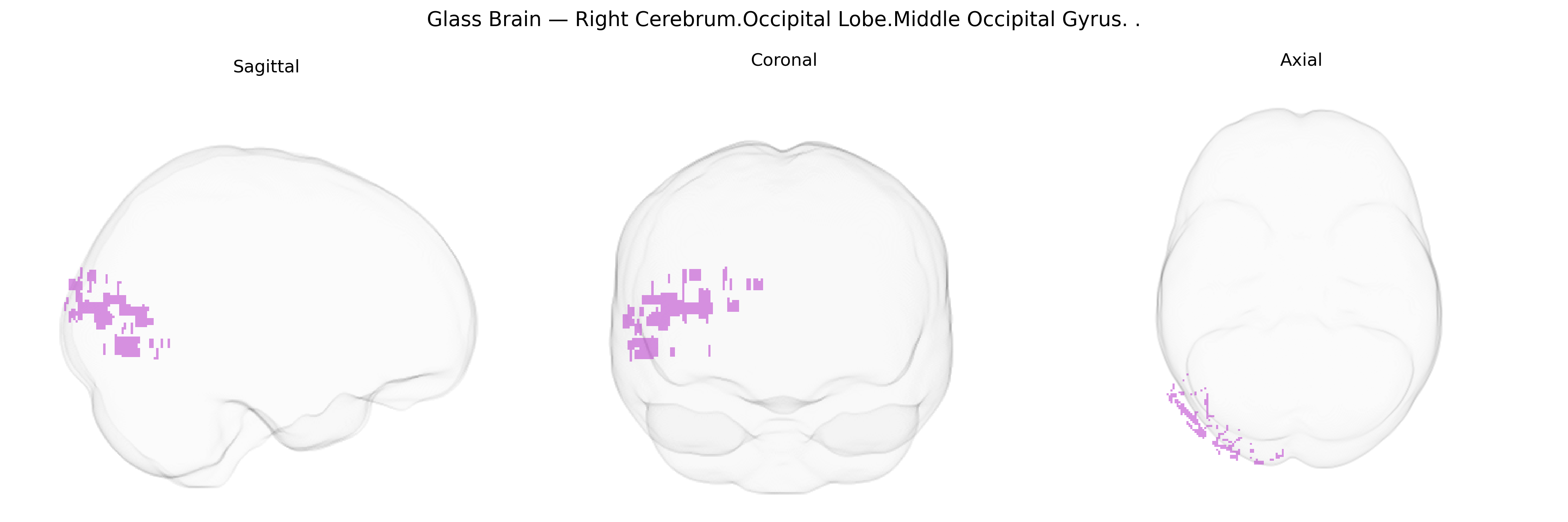 Triplanar Ghost Brain