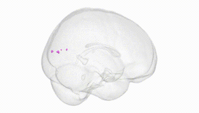 Full Brain White