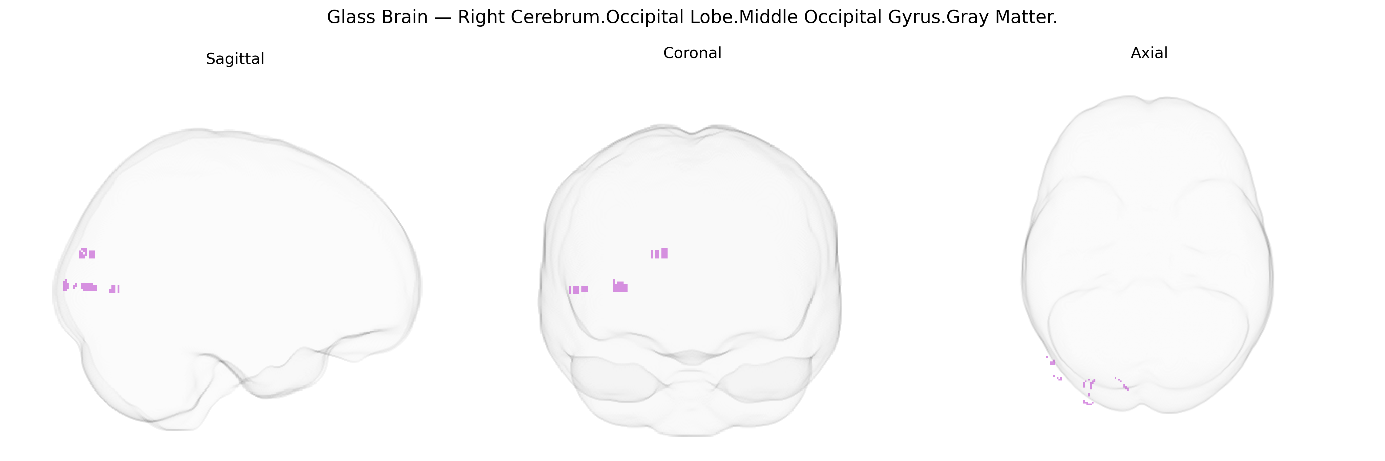Triplanar Ghost Brain