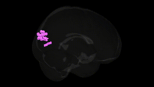 Full Brain Black