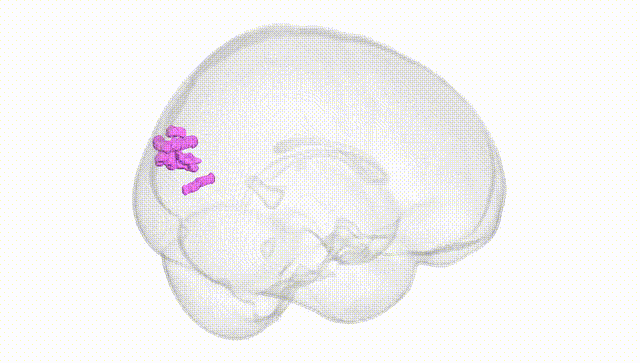 Full Brain White