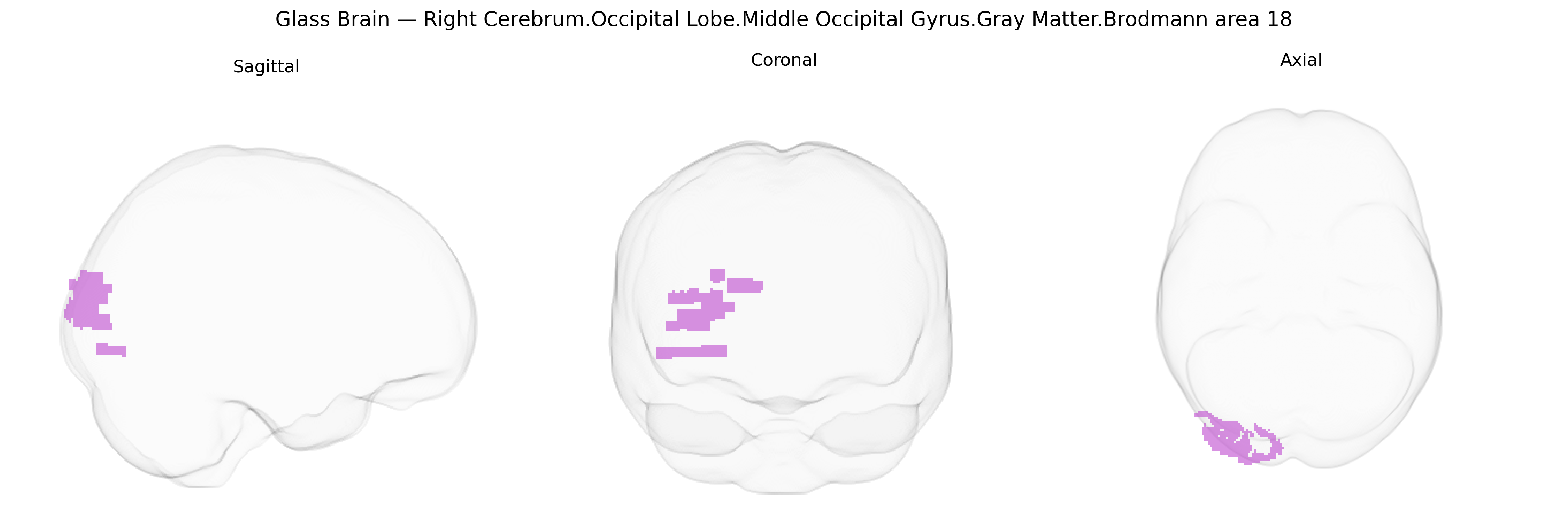 Triplanar Ghost Brain
