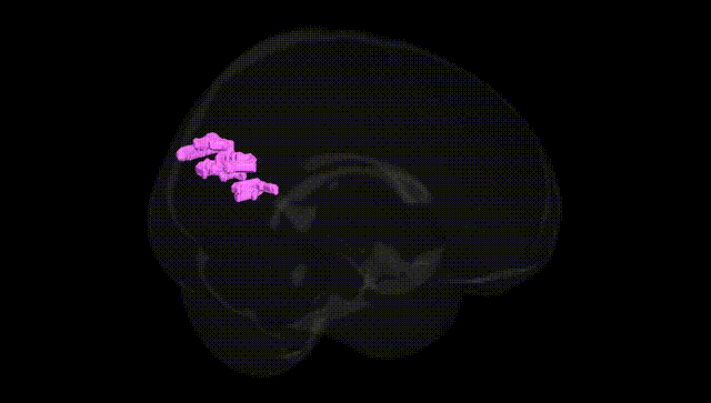 Full Brain Black