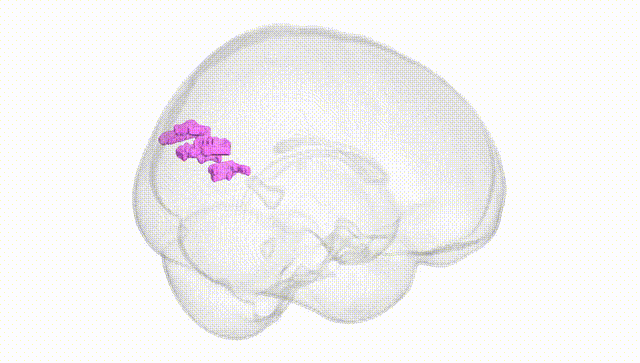Full Brain White