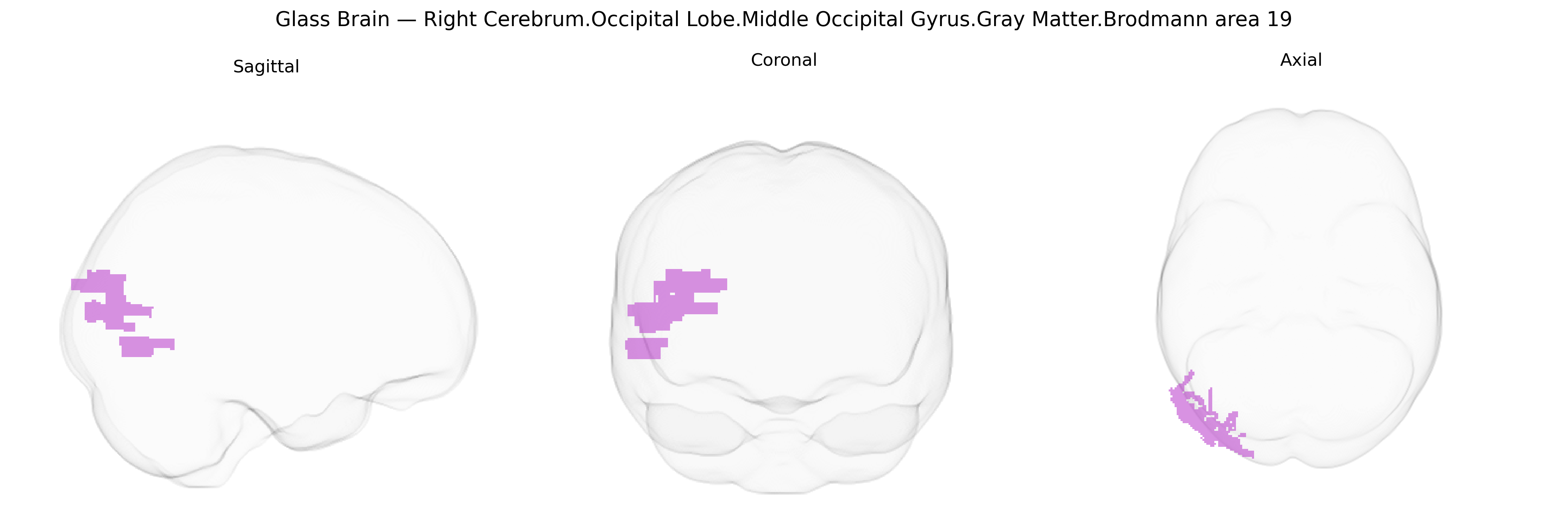 Triplanar Ghost Brain