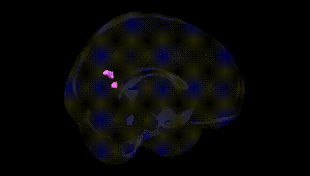 Full Brain Black