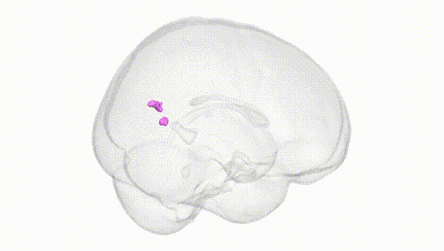 Full Brain White