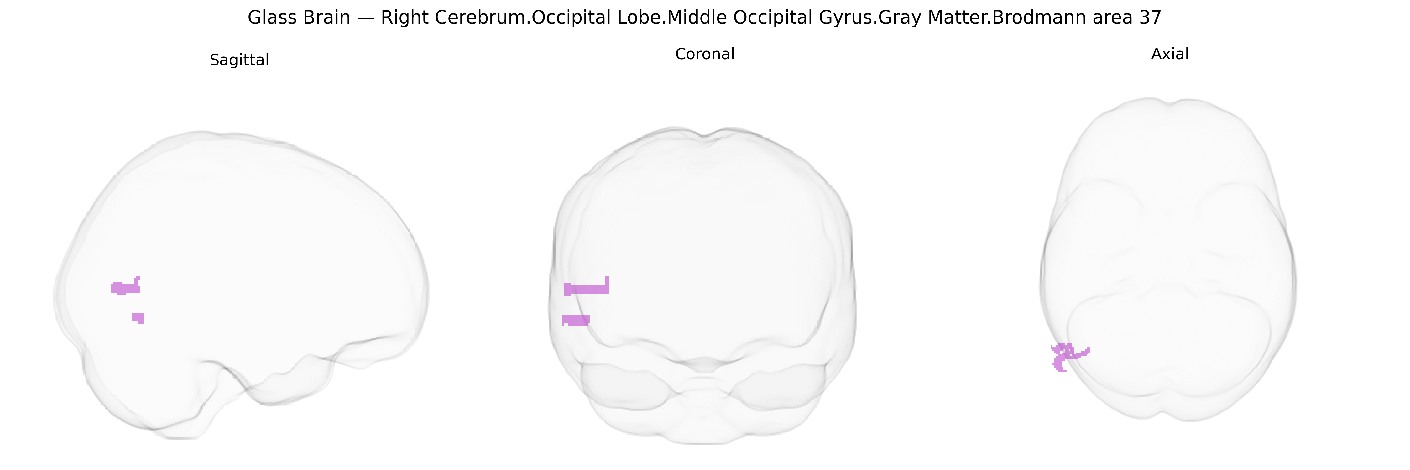 Triplanar Ghost Brain