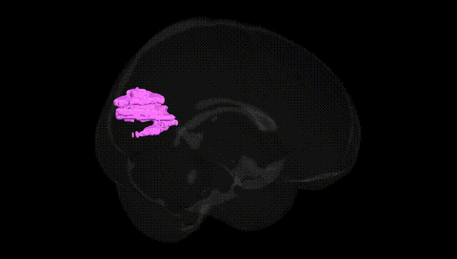Full Brain Black