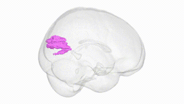 Full Brain White
