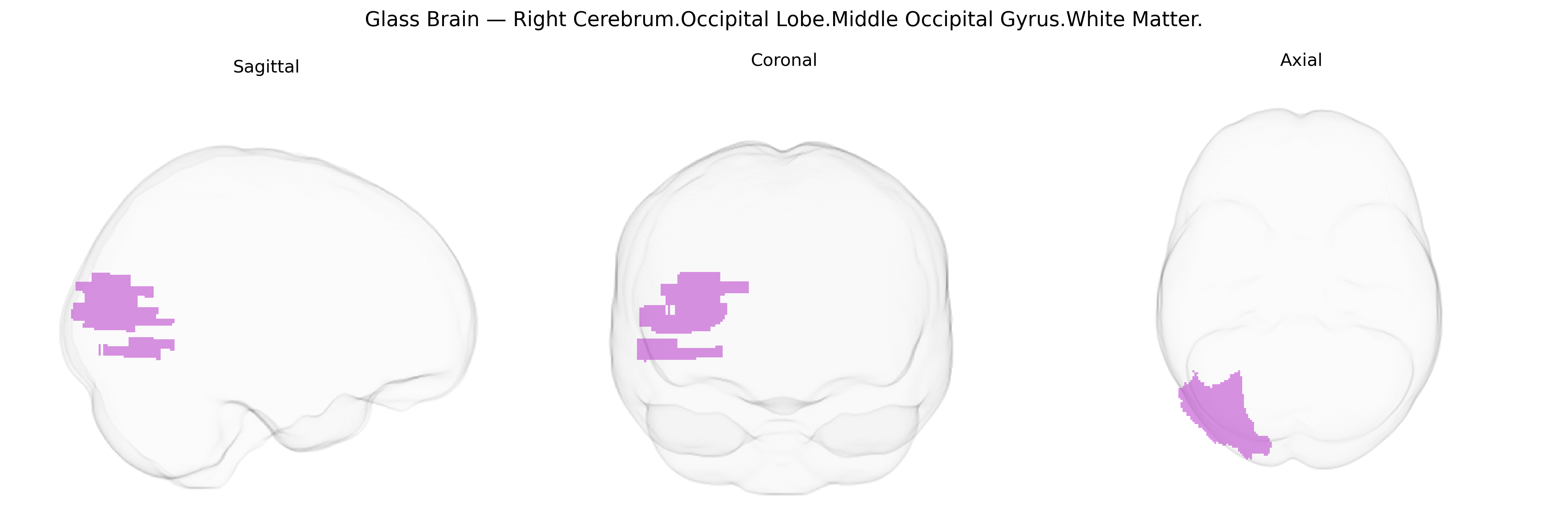 Triplanar Ghost Brain