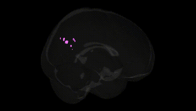 Full Brain Black