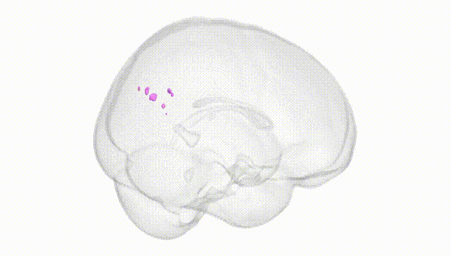 Full Brain White