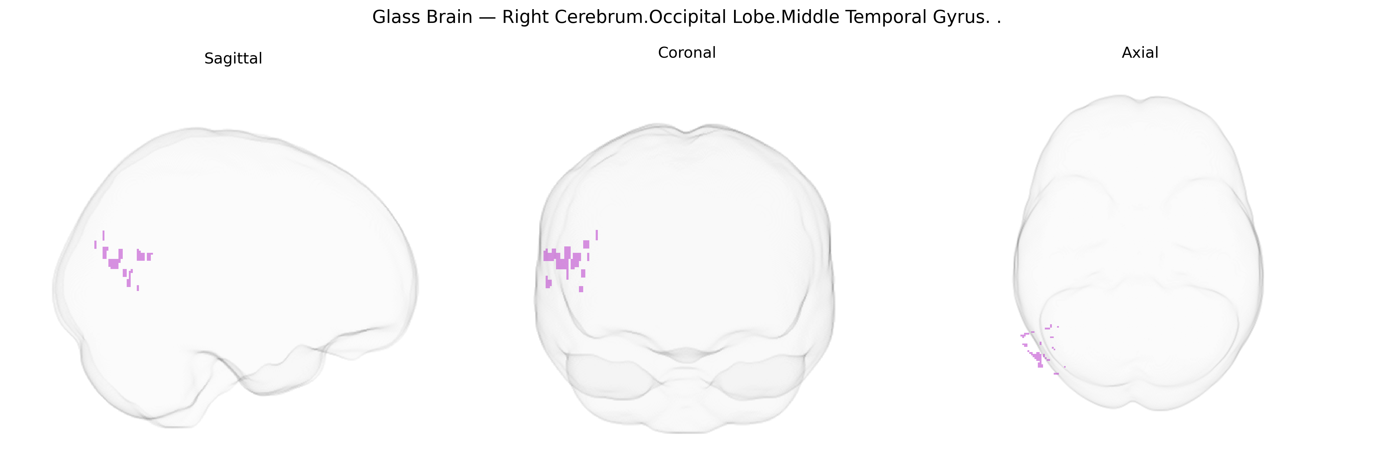 Triplanar Ghost Brain