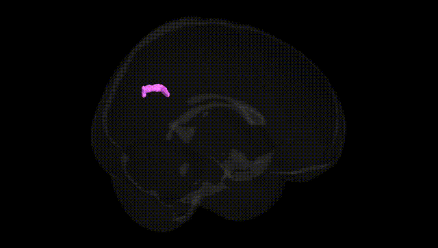 Full Brain Black