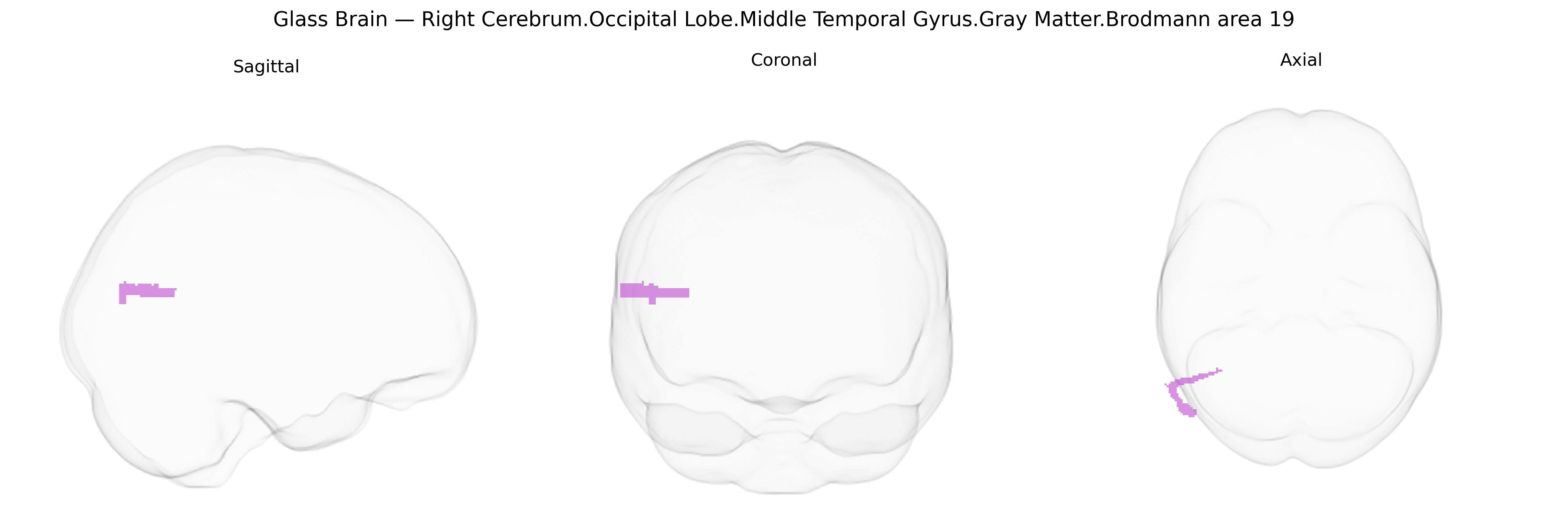 Triplanar Ghost Brain