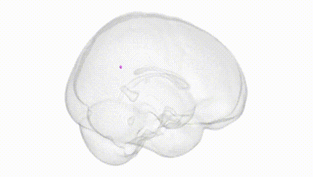 Full Brain White