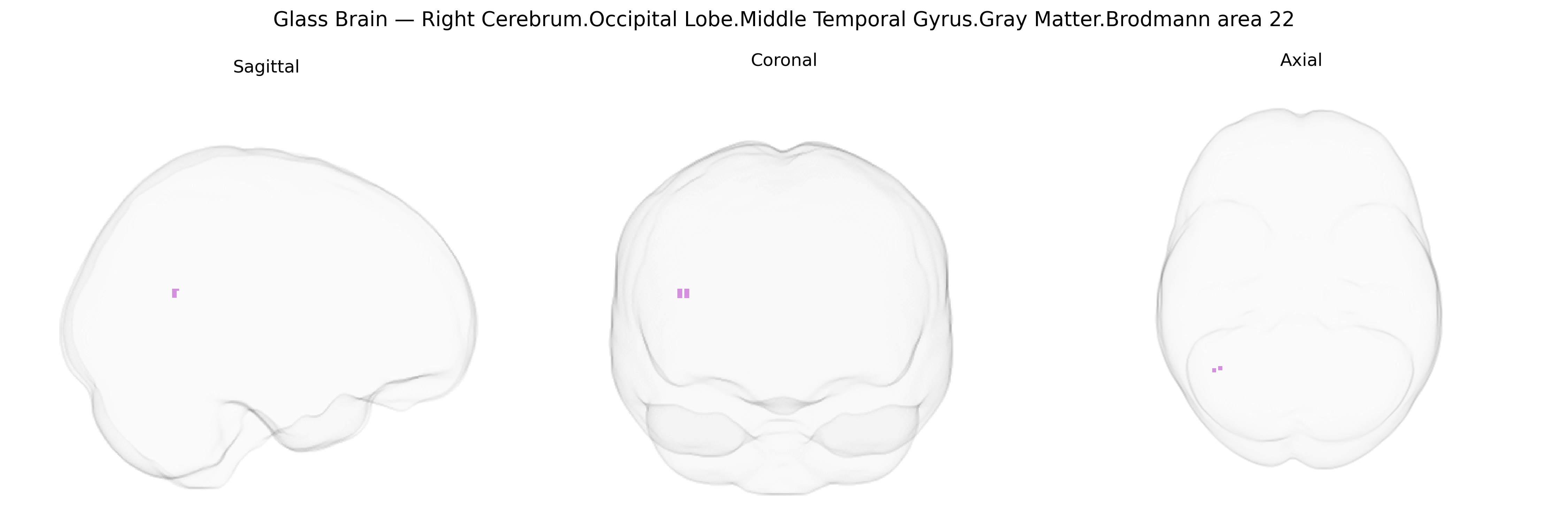 Triplanar Ghost Brain