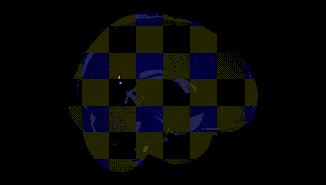Full Brain Black