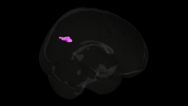 Full Brain Black