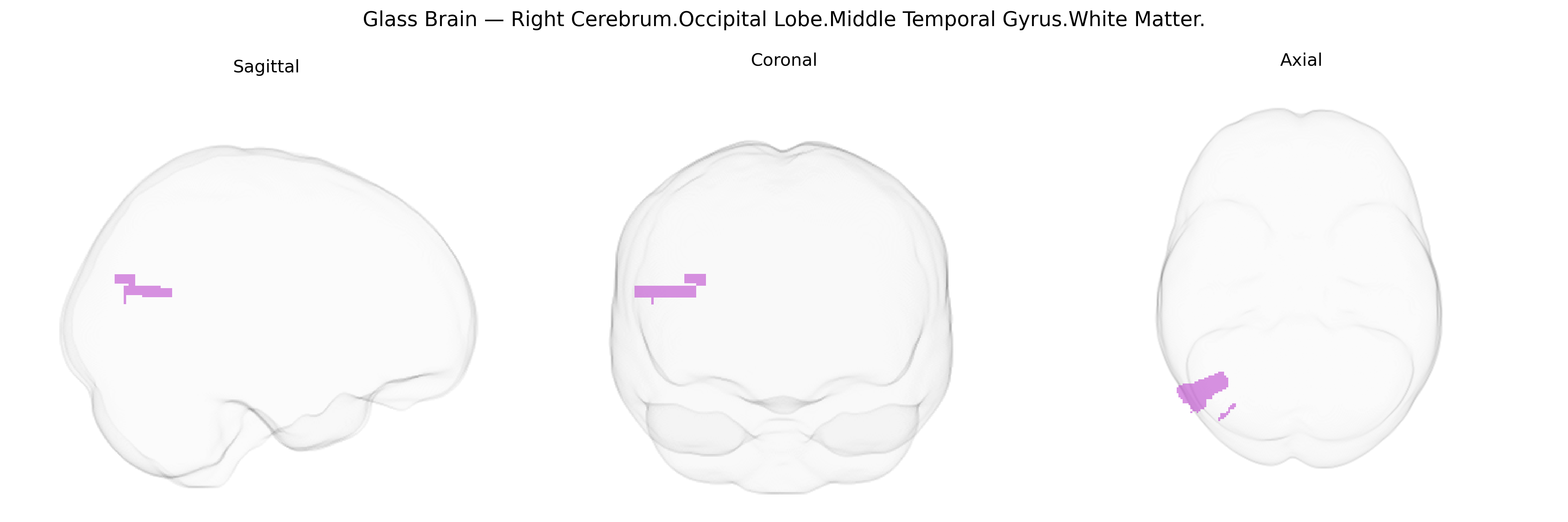 Triplanar Ghost Brain