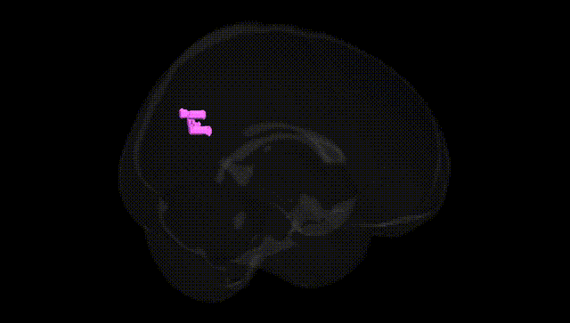 Full Brain Black