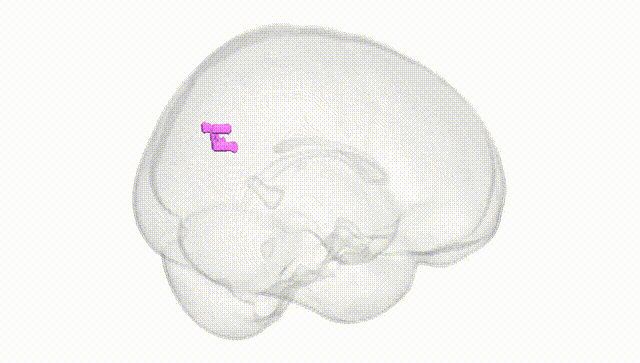 Full Brain White