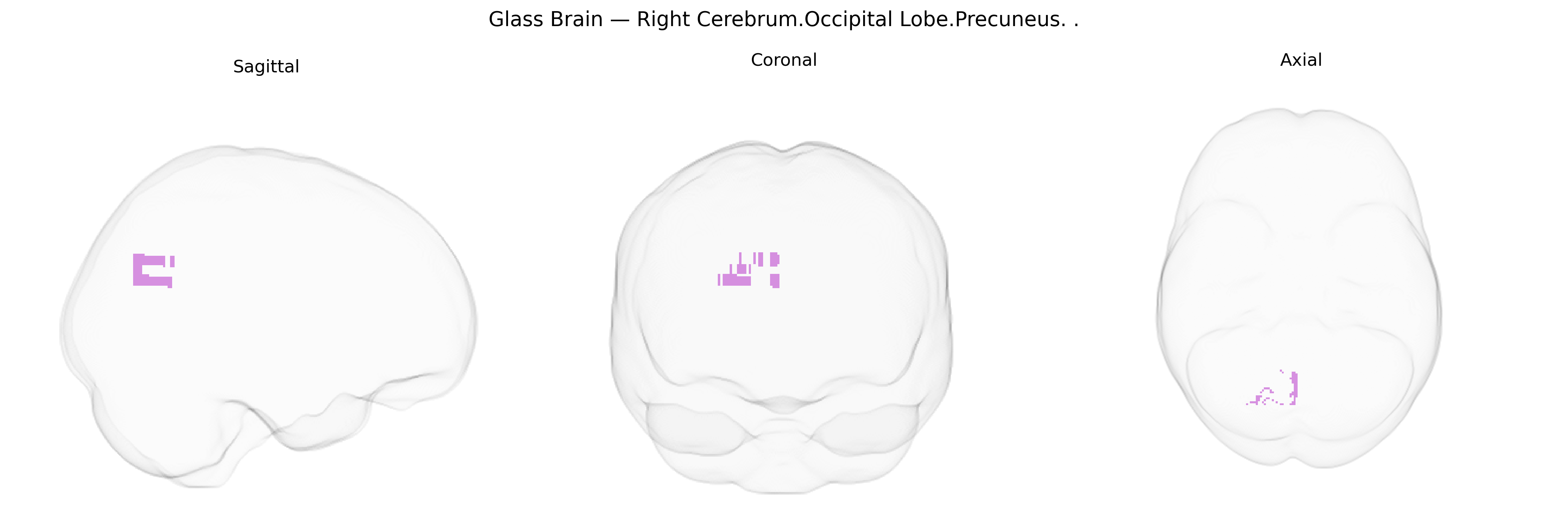 Triplanar Ghost Brain