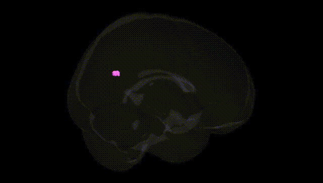 Full Brain Black