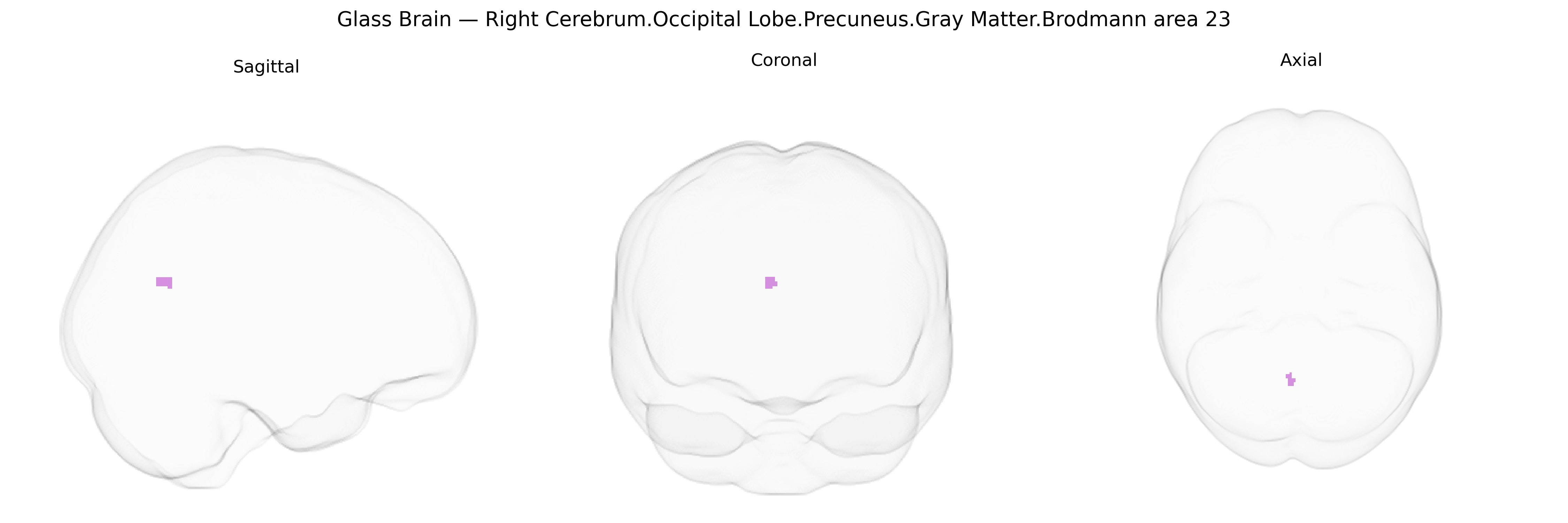 Triplanar Ghost Brain