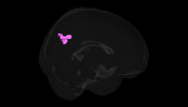 Full Brain Black