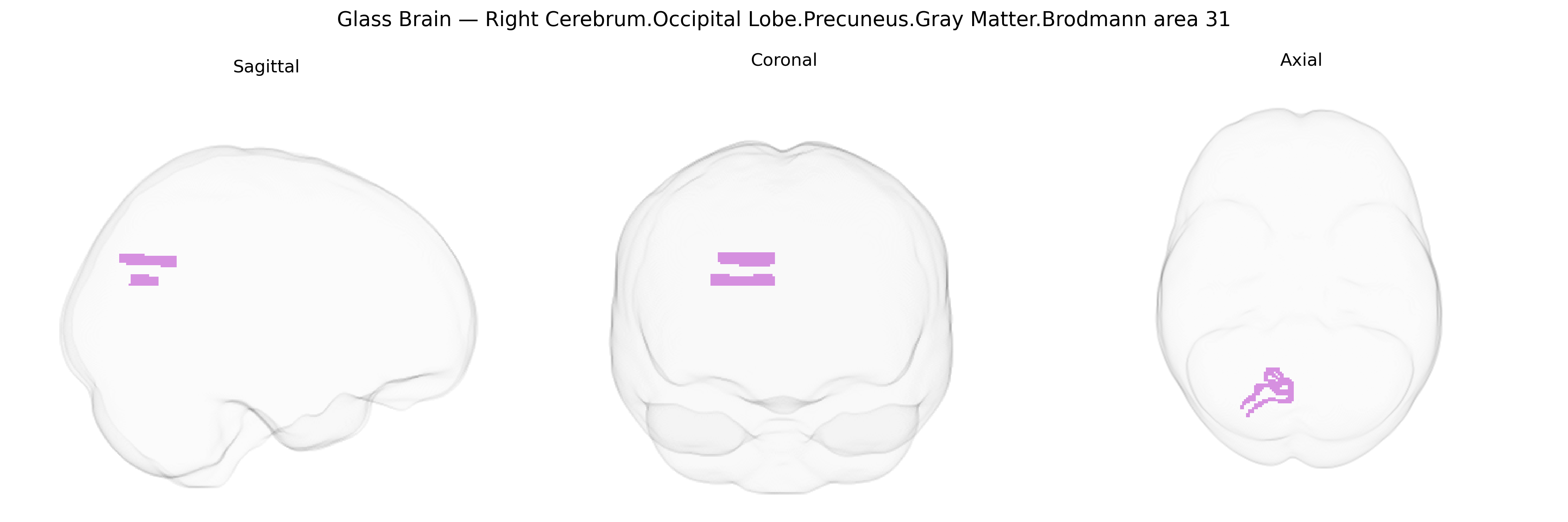Triplanar Ghost Brain