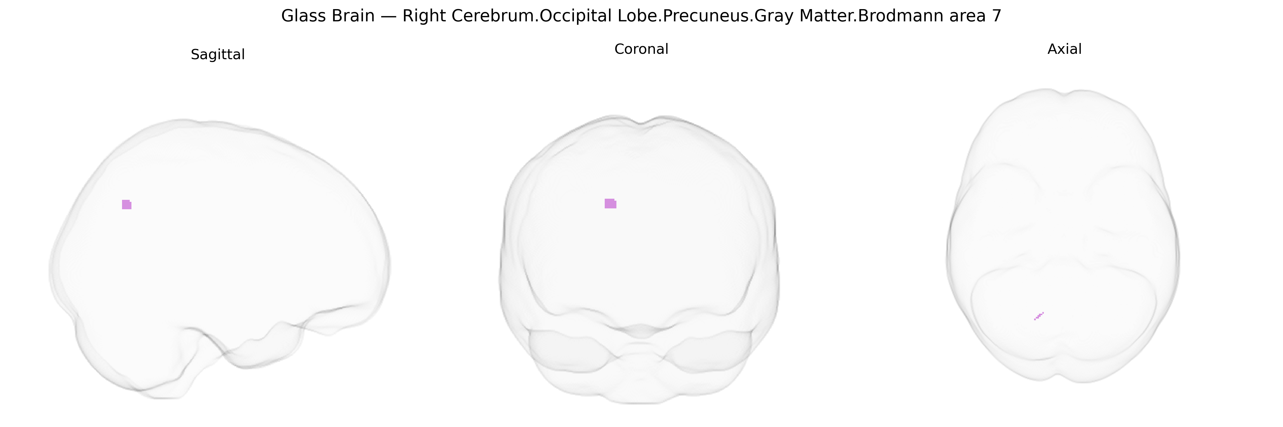 Triplanar Ghost Brain