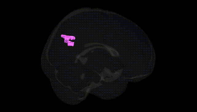 Full Brain Black