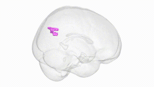 Full Brain White