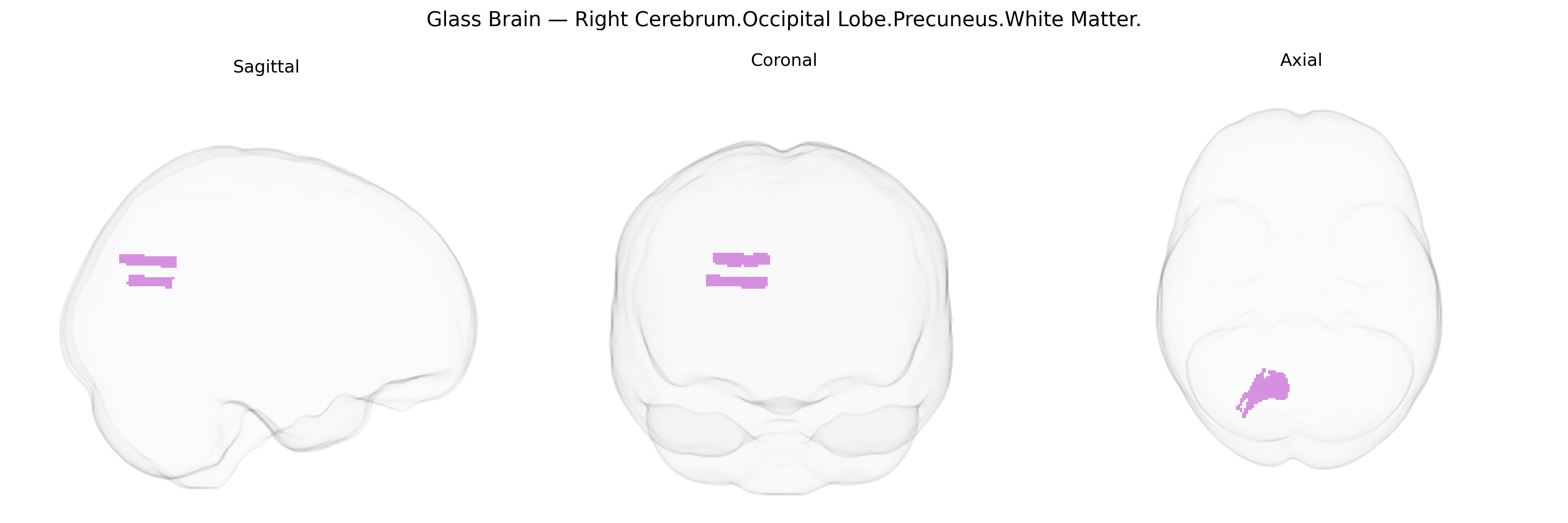 Triplanar Ghost Brain