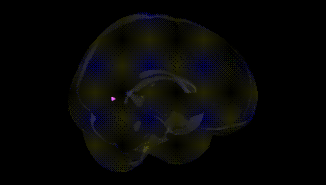 Full Brain Black