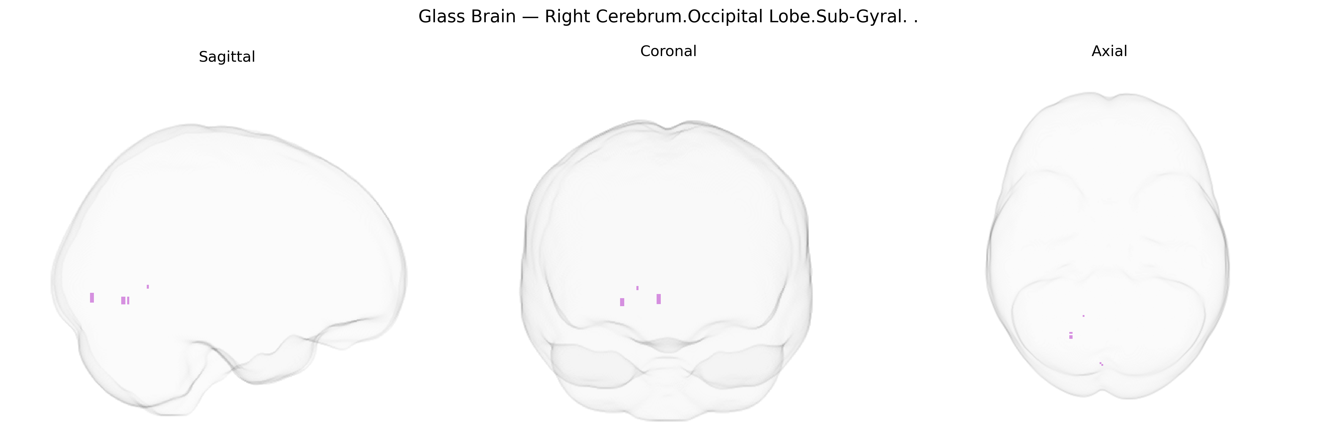 Triplanar Ghost Brain