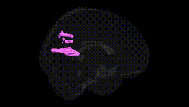 Full Brain Black