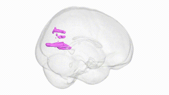 Full Brain White
