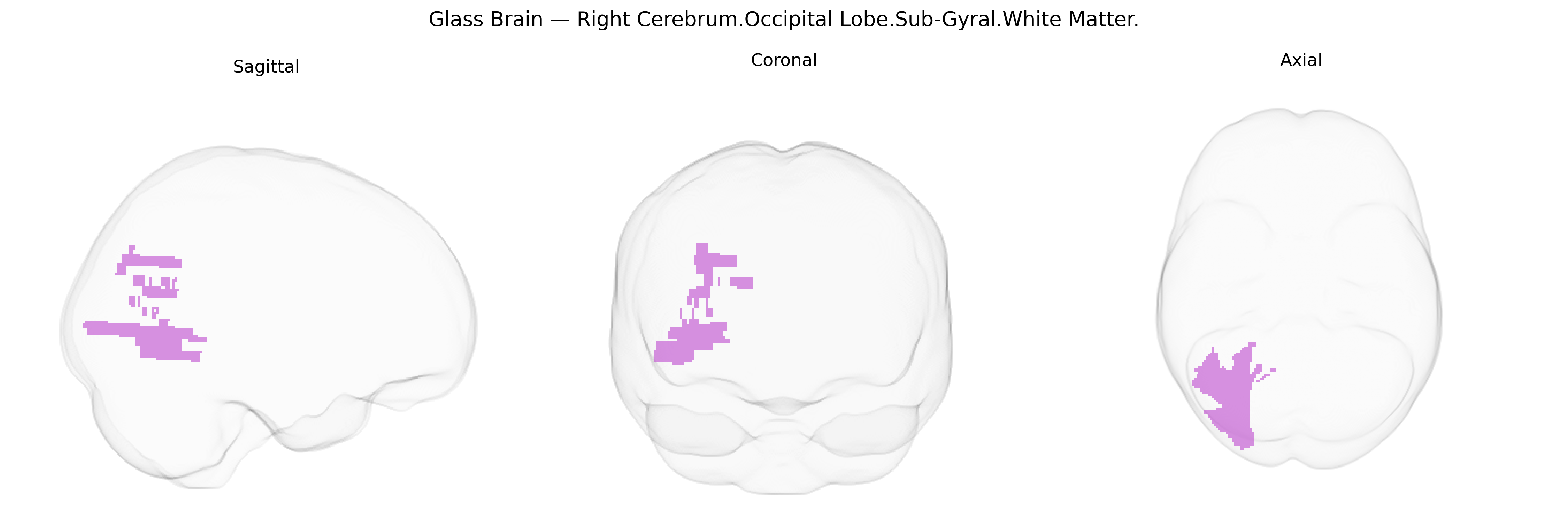 Triplanar Ghost Brain