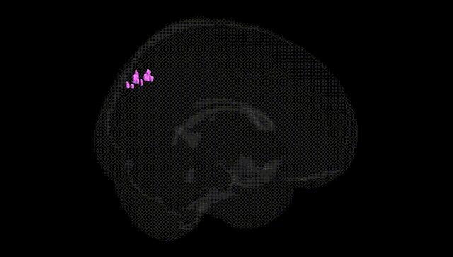 Full Brain Black
