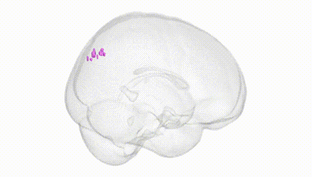 Full Brain White