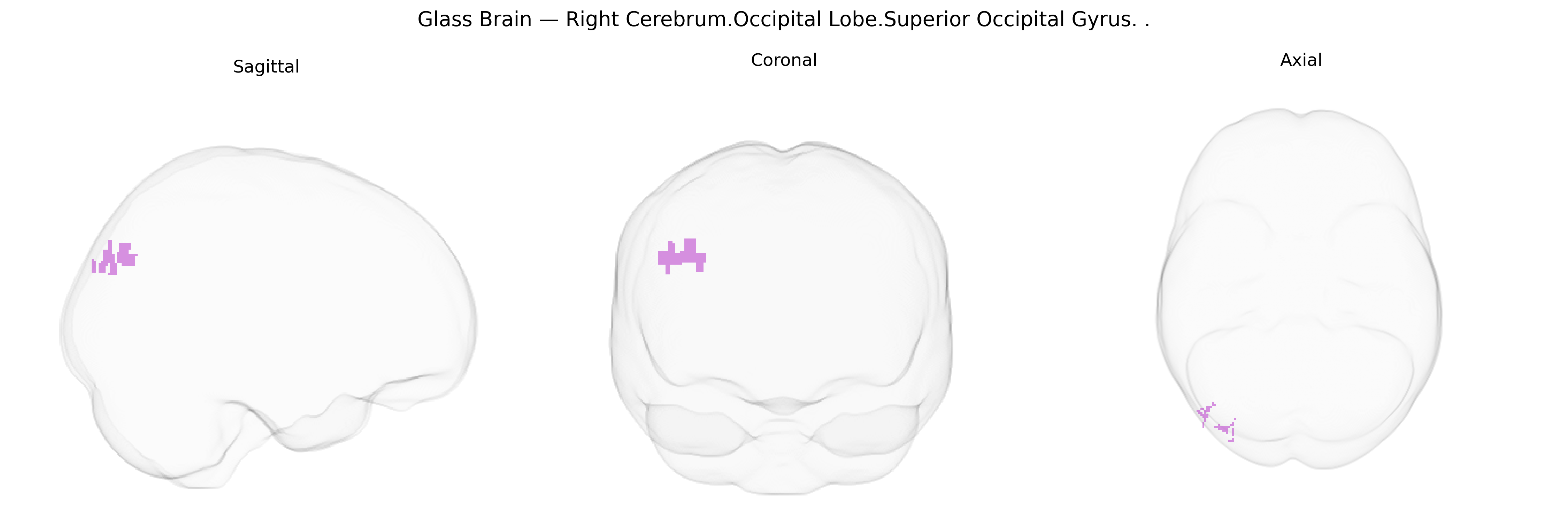 Triplanar Ghost Brain
