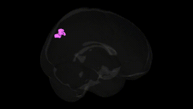 Full Brain Black