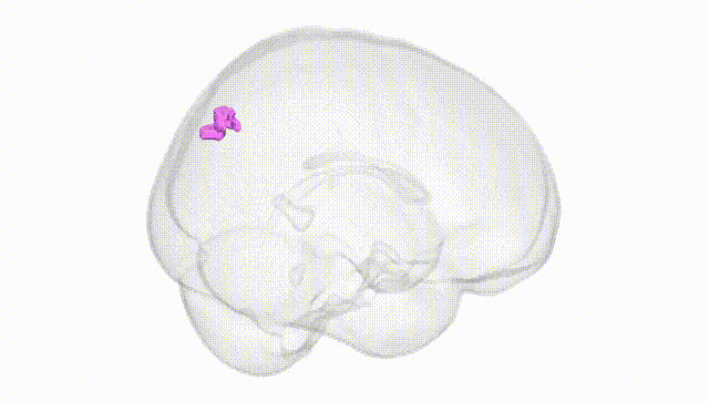 Full Brain White
