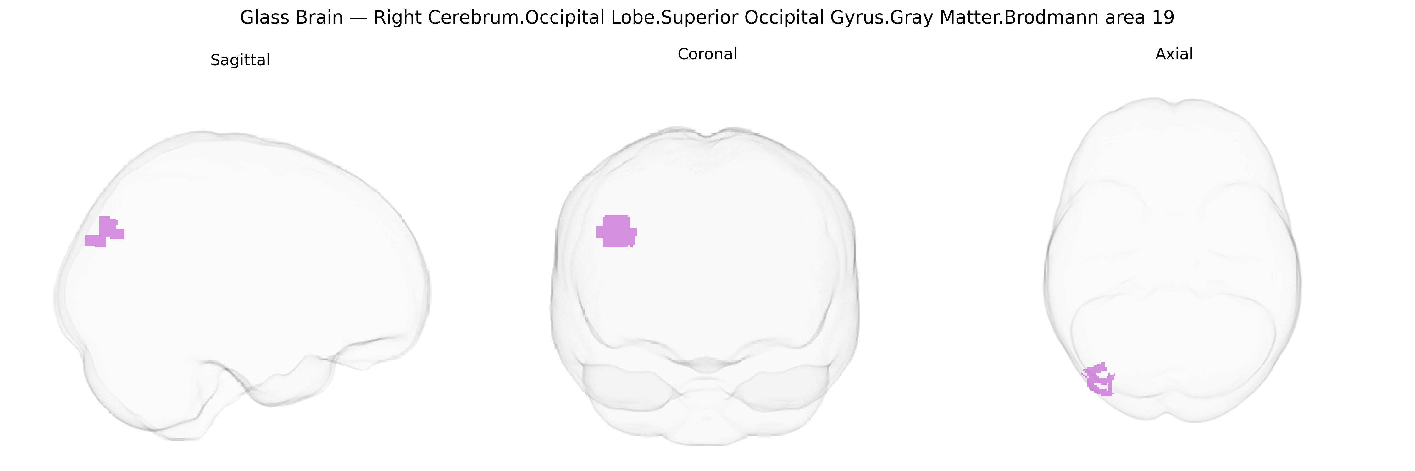 Triplanar Ghost Brain
